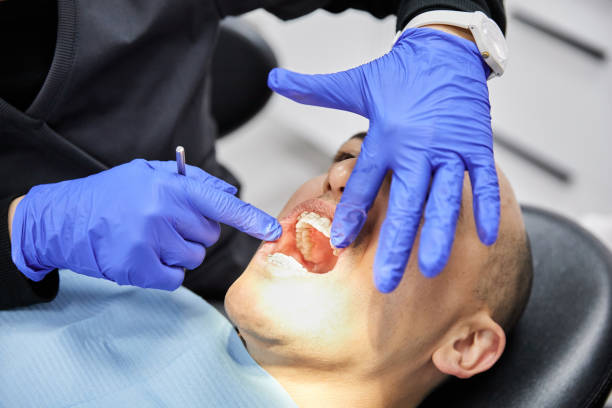 Best Knocked-Out Tooth Emergency  in , ND
