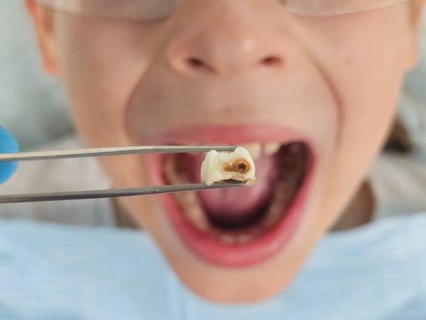 Best Tooth Infection Emergency Dentist  in , ND